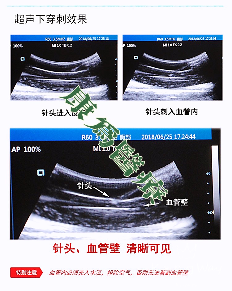 “康為醫(yī)療”超聲引導下血管穿刺訓練模塊