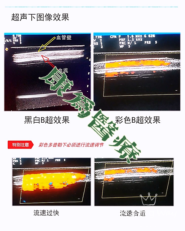 “康為醫(yī)療”超聲引導下血管穿刺訓練模塊